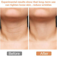 Facial anti-wreck device, facial massager, skin care device, tightens and smoothes the skin.