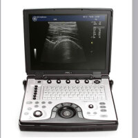 GE Logiq E R7 ultrasound machine, used, with scratches,...