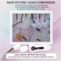 15" Skin and Scalp Analysis Device, Ultra-HD Hair...