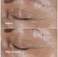 Clinique Smart Clinical Repair Augencreme 15 ml, Faltenreduzierung, Anti-Aging Pflege